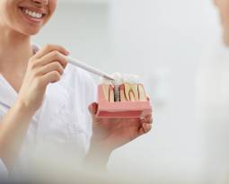 Implants vs. Dentures